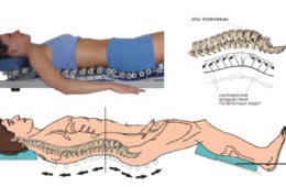 Cum se elimină hernia intervertebrală din China Prezentare generală a metodelor de tratament