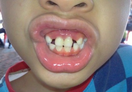 Când se formează dinți la un copil