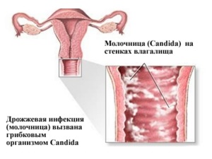 Când pot să folosesc gexiconul în timpul sarcinii