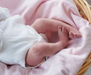 Clubfoot la copii provoacă, tratament