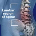 Metode minim invazive de tratare a durerii de spate