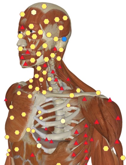 Metapathia spital, software, ipp (ipp metatron) - diagnosticare computerizată