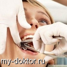 Metode de extracție a dinților