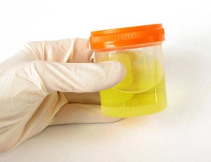 Așa cum este indicat de mirosul de acetonă în urină, ginecologie și urologie online