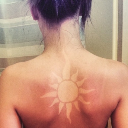 Az instagram új trendje a napégés nyomainak mint művészetnek