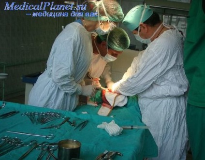 Poziția chirurgului și a asistenților în ginecologie