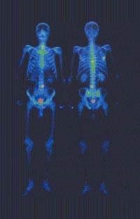 A gyakorlati radiológus - roentgenológia, röntgenfelvételek, sugárdiagnosztikai sugárterápiák helyszíne -