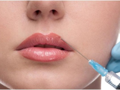 Modalități de pompare a buzelor cu pompare de buze botox, electroporare și alte proceduri