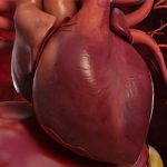 Inima tirotoxică - cauze, simptome și tratament