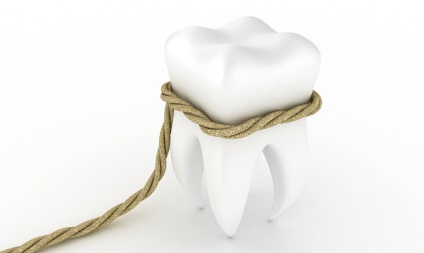 Extracția dinților în stomatologia modernă, indicații pentru extracția dinților și metodele de extracție a dinților