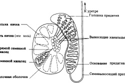 Varicele ale scrotului