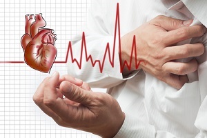 Totul despre infarctul miocardic, recenzorul medical