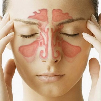 Krónikus sinusitis tünetei és krónikus sinusitis kezelése felnőtteknél és gyermekeknél, szövődmények