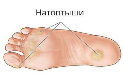 Отруйна рослина жовтець їдкий опис, властивості, місця произростания