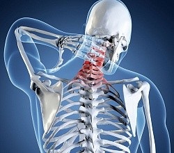 A nyaki gerincműtét csontritkulása, a kezelés tünetei és módszerei