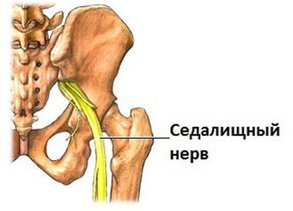 Boli ale articulației șoldului la femei - tipuri, cauze, simptome