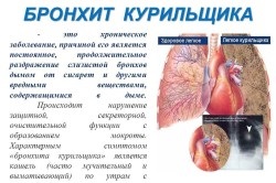 Bronșita simptome, tratament, medicamente