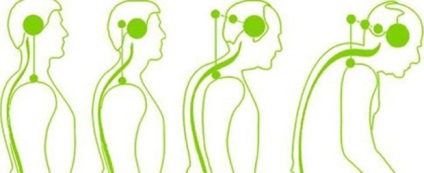 Principalele cauze ale osteocondrozei diferitelor departamente