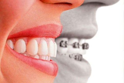 Egy híres fogorvos elmondta a fogfehérítésről és a julia robertsről