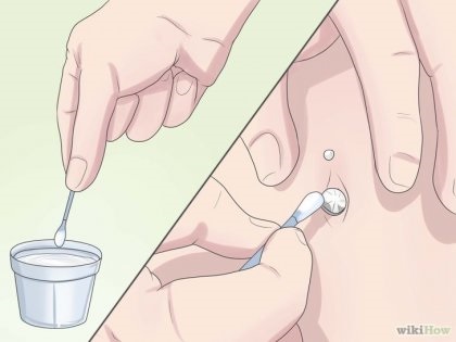 Cum să cureți o piercing ombilic