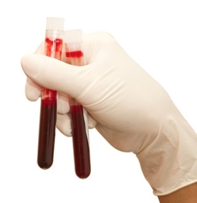 Milyen gyógynövények és hogyan befolyásolják a vér tisztítását és tisztítását - az orvosok neumyvakina,