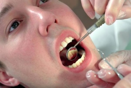 Cum să știți că dintele este putred