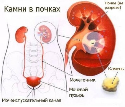 Kesudió - az anyatej előnye és ártalma az emberi test számára