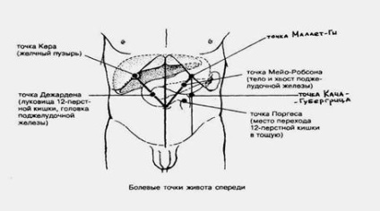 Chisturile și fistulele pancreasului (pzh) - stadopedia