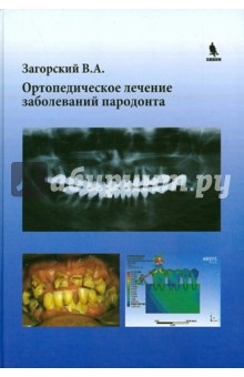 Cartea este un tratament ortopedic al bolilor parodontale - Valerii Zagorsky