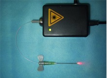 Terapia cu laser a organelor interne