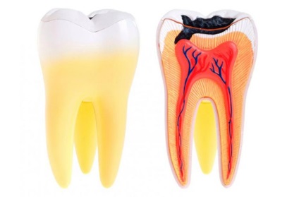 Tratamentul unui chist al unui dinte în moscow la prețuri scăzute, stomatologie ausculapius