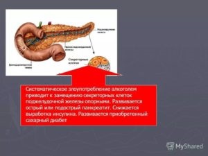 Pot bea alcool cu ​​un ulcer gastric?