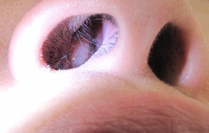 Creșterea nasului pe sept în fotografierea unei persoane, motivele, ce și cum să tratăm