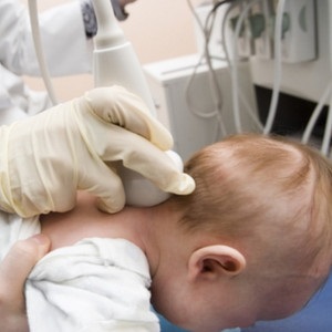 Neurosonografia creierului nou-născuților, uzi la sugari-bebeluși din Sankt-Petersburg