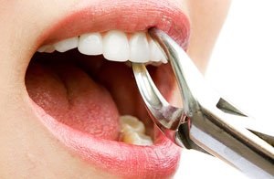 Despre ce vorbesc, dar dentiștii vor să le spună pacienților lor