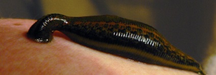 Leeches cu osteocondroză (tratament, hirudoterapie) cervical, lombar