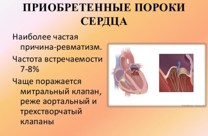 Insuficiența cardiacă și sarcina - naștere congenitală, naștere
