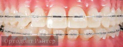 Seminarii, cursuri și cursuri de ortodonție și paranteze
