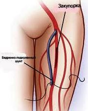 Măsurarea - manevrarea navelor