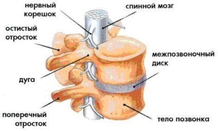 Spondiloliza vertebrei este un simptom, un tratament