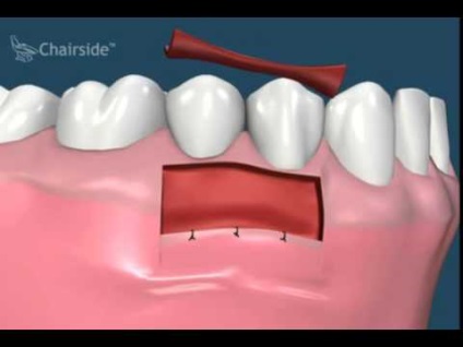 Se explică cauzele apariției dinților supercompletați
