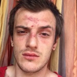 În Odessa, bate bloggerul Sasha Shapika