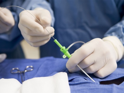 В България ще има още един Федералния център за сърдечно-съдови хирургия - наръчника вестник