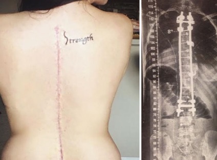 28 Tatuaj frumos, ascunzând artificiale cicatrici