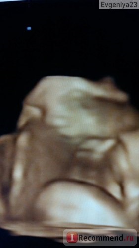 4D uzi în timpul sarcinii - 