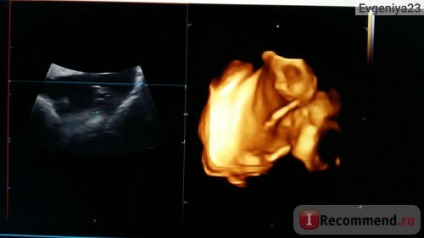 4D uzi în timpul sarcinii - 