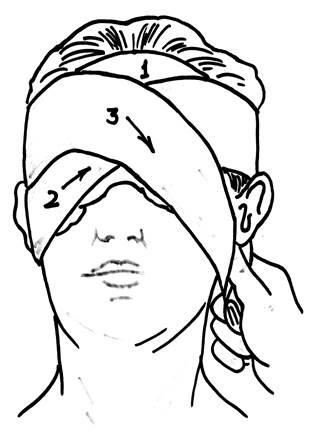 Algoritmul aplicării unui bandaj la un singur ochi (monocular)