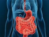 Boala lui Crohn cauzează, simptome, tratament