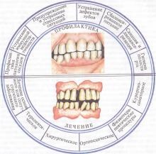 Examinarea clinică, parodontita și parodontita, tratamentul bolilor parodontale
