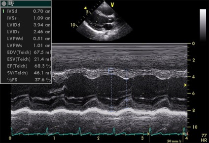 Echocardiografia în centrele medicale din St. Petersburg, prețuri și recenzii